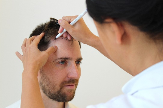 Hair fixing in Dubai consultation for non-surgical hair replacement with a customized natural hair system for men.