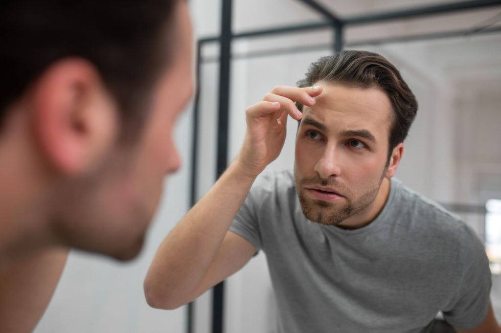 Hair fixing in Dubai procedure showing the application of a natural non-surgical hair replacement system for men.